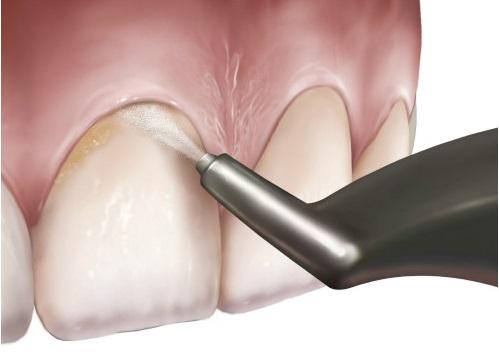 Dental Technology | Dr Hughs